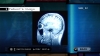 thumbs traumateam screens diagnosis 01 Trauma Team Review