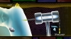 thumbs traumateam screens orthopedics 03 Trauma Team Review